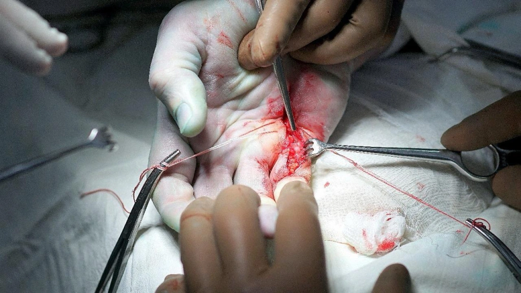 u75YAgv8l0q1XqGCPVFp7LxFroU8Vb0JFQxItiLW9E3DFDwV9uH2eIB8eCya12q7uIOmZzmdEiXVv_Lr963i_MIo.jpg u75YAgv8l0q1XqGCPVFp7LxFroU8Vb0JFQxItiLW9E3DFDwV9uH2eIB8eCya12q7uIOmZzmdEiXVv_Lr963i_MIo.jpg