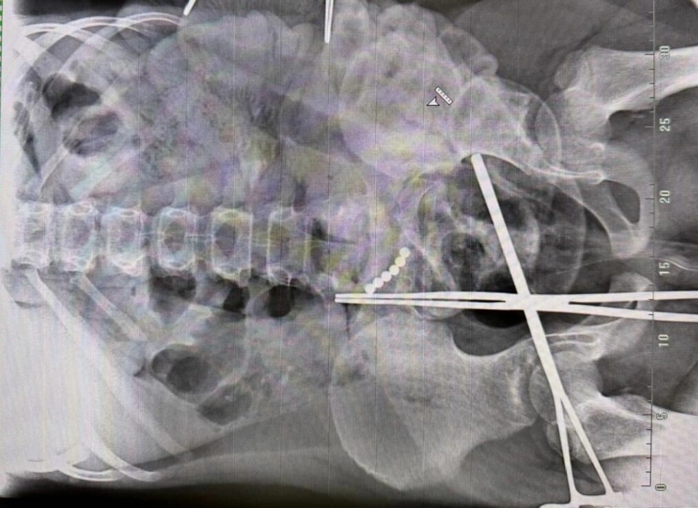 m8yg49i3u1u9tk7bnvnwa3b1k53yrhnx (1).jpg m8yg49i3u1u9tk7bnvnwa3b1k53yrhnx (1).jpg