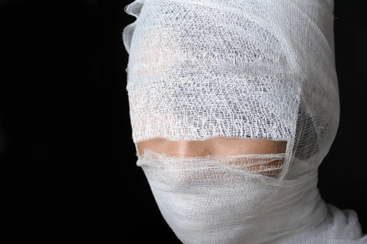 Фото: перевязанная голова \\ кадр из публикаций 1rnd.ru