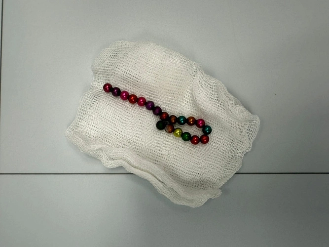 Фото: магнитные шарики // фото ОДКБ