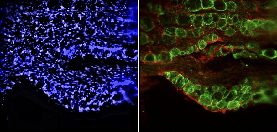 Фото: Учёная ЮФУ впервые в истории изучила процессы гибели и выживания белков при повреждении нервных волокон