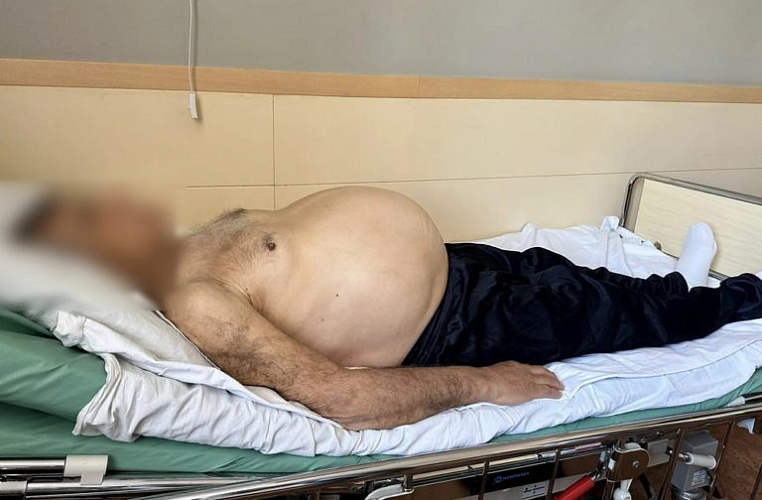 Фото: ФГБУ «НМИЦ онкологии» Минздрава России